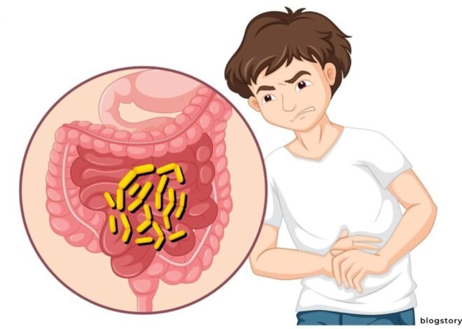 Eliminate Your Constipation Forever With Ayurvedic Tips and Remedies