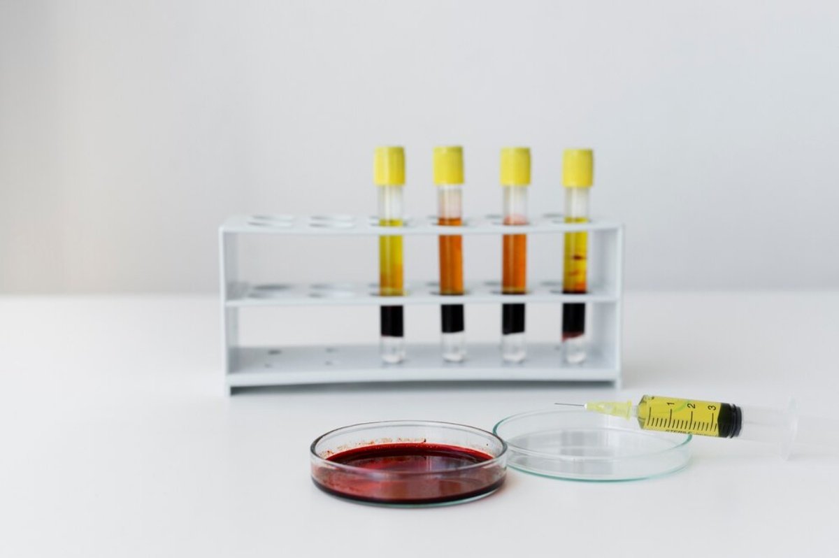 What Are Ehrlich Reagent Test Kits?